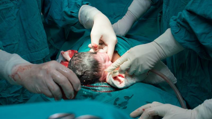 Cutremurător: bebeluşul care s-a născut cu un şrapnel înfipt în cap. Cum a fost posibil
