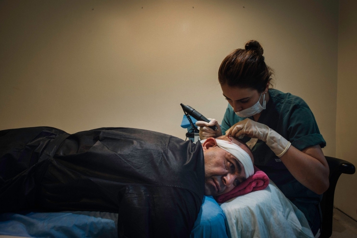 Solutia minune pentru chelie