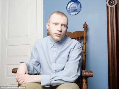 GALERIE FOTO. Imagini uimitoare cu persoane care suferă de albinism. Rămâi fără cuvinte
