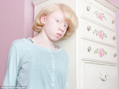 GALERIE FOTO. Imagini uimitoare cu persoane care suferă de albinism. Rămâi fără cuvinte
