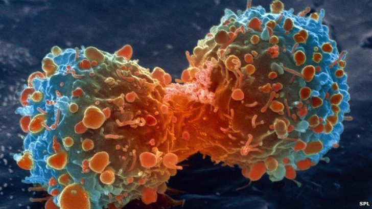 Cercetătorii au găsit un posibil leac împotriva cancerului. Tratamentul, descoperit din întâmplare