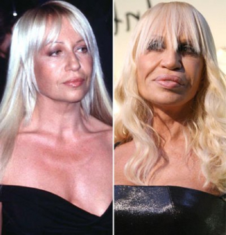 Nu o s-o recunoşti! Cum arăta Donatella Versace, înainte de operaţiile estetice care au desfigurat-o