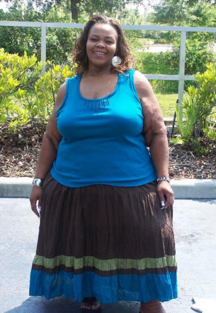 Cea mai grasă femeie din lume, transformare incredibilă: a slăbit 230 de kg. Cum arată acum