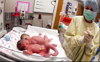 Gemenii nou-născuți s-au oprit din plâns numai după ce medicii au făcut asta. E uimitor!