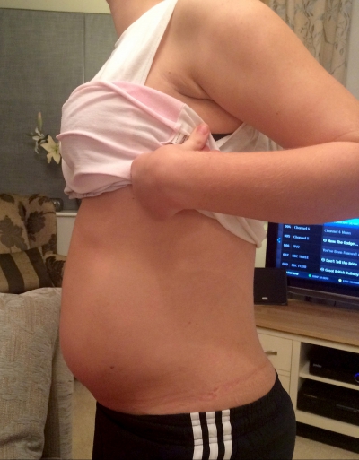 S-a dus la doctor, crezând că este însărcinată. Medicii au amuţit când i-au examinat abdomenul