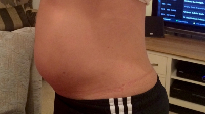 S-a dus la doctor, crezând că este însărcinată. Medicii au amuţit când i-au examinat abdomenul