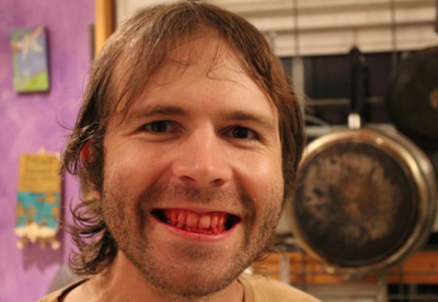 Cum arată omul care mănâncă doar carne crudă de 7 ani încoace. FOTO ȘOCANT