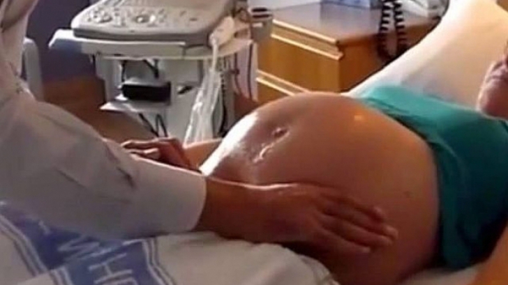 Expusă radiațiilor în timpul sarcinii, a sperat că totul va fi bine. Ce a născut la final..e șocant