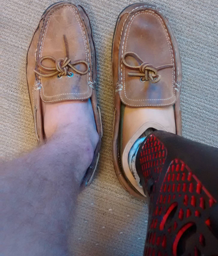 Diferența dintre uzura pantofilor mei, după un an de purtare. Explicația? Neașteptată și șocantă