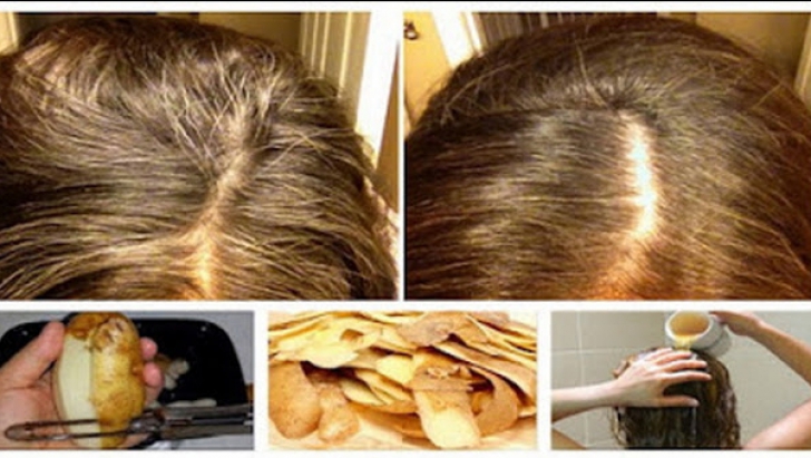 Efectul uimitor al cartofilor asupra părului. Nu vei mai avea nevoie de vopsea. Ce trebuie să faci