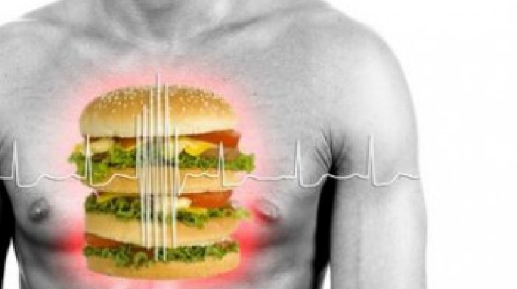6 factori ai infarctului miocardic