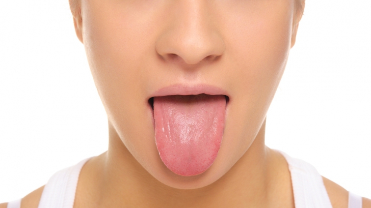 Ce înseamnă dacă ai limba crăpată. HARTA bolilor grave care se văd în oglindă