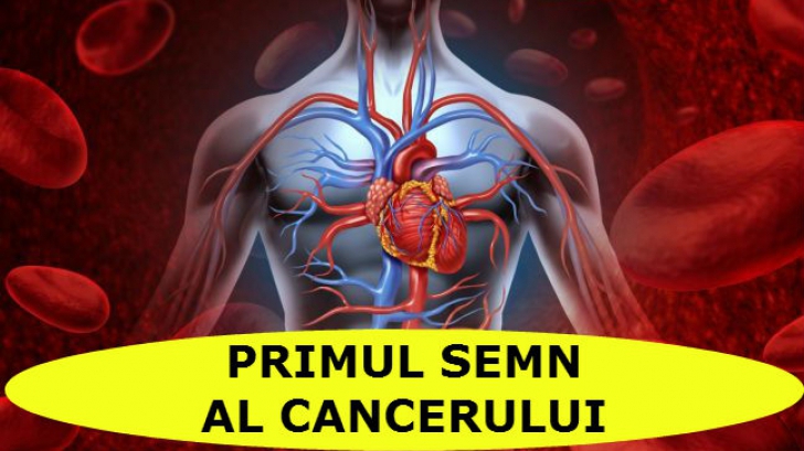 Atenție! Nu ignora! Primul semn al cancerului! Verifică aici