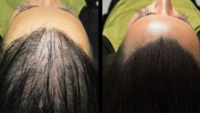 Reţeta magică pentru creşterea rapidă şi naturală a părului. Rezultate sunt surprinzătoare!