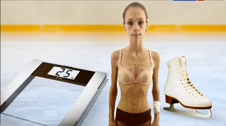 Coşmarul unei sportive de top din Rusia: cântărea doar 24 de kg, iar medicii au forţat-o să...