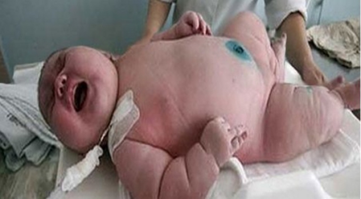 O femeie de 250 kg a născut un copil de 16 kg. Cum arată cel mai mare nou-născut de până acum