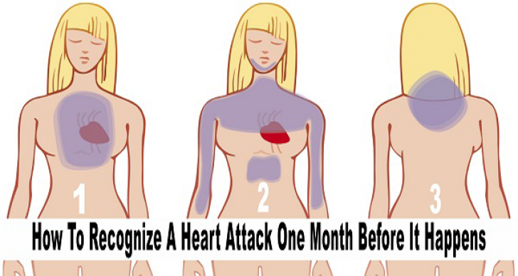Semnele care îţi arată un atac de cord cu o lună înainte ca acesta să se producă