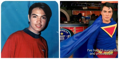 A vrut să semene cu Superman şi şi-a făcut 23 de operaţii estetice. Cum s-a transformat acest tânăr
