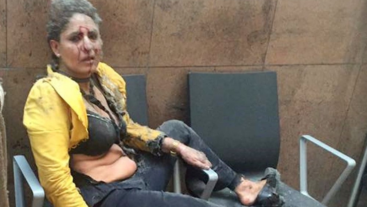 Fotografia care a făcut înconjurul lumii.Cine e femeia din imagine rănită în atentatul din Bruxelles