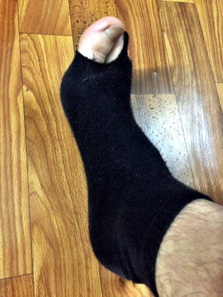 Mai multe vedete au pus pe Facebook poze cu ciorapi rupţi. Motivul e incredibil!
