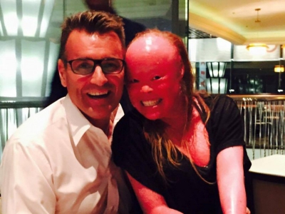 Şi-au ascuns copilul 22 de ani pentru ca nimeni să nu-i vadă faţă. Cum arată în realitate. E ŞOCANT