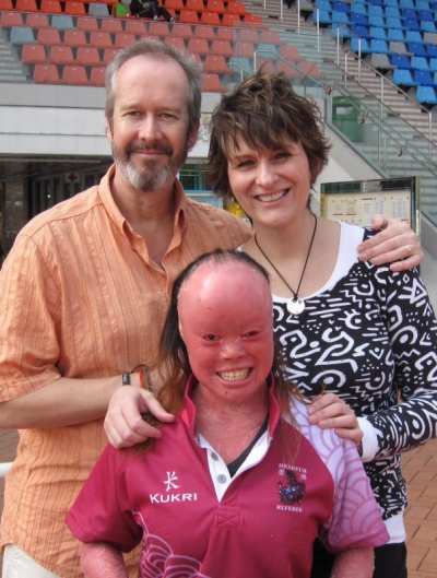 Şi-au ascuns copilul 22 de ani pentru ca nimeni să nu-i vadă faţă. Cum arată în realitate. E ŞOCANT