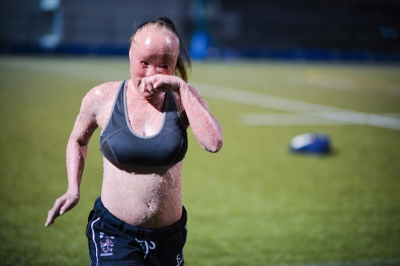 Şi-au ascuns copilul 22 de ani pentru ca nimeni să nu-i vadă faţă. Cum arată în realitate. E ŞOCANT