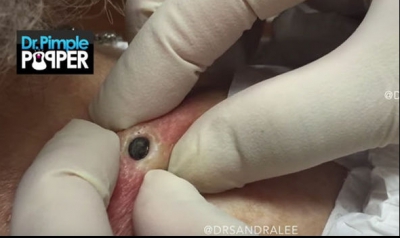 A strâns puternic ”alunița” de pe umăr. Era să cadă din picioare când a văzut ce iese! Așa ceva...