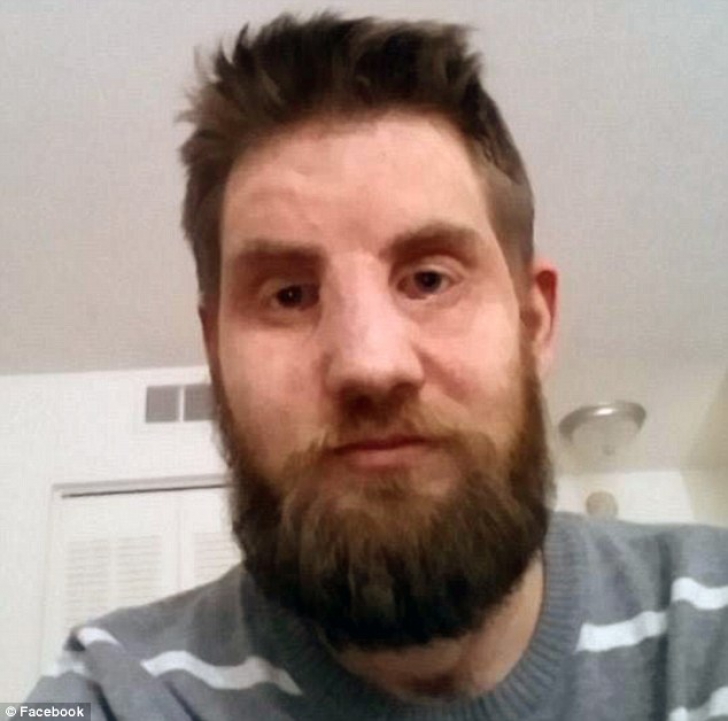 Povestea emoționantă a eroului care a făcut transplant de față. Transformarea e uluitoare