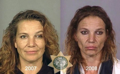 Adevărata faţă a drogurilor. Transformări şocante: înainte şi după consumul de heroină