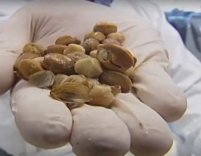 Cum arată fructele care ucid cancerul &icirc;ntr-un minut. Medicii, ŞOCAŢI c&acirc;nd au văzut efectele