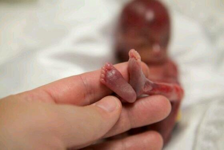 E cel mai mic nou născut din lume. La naștere tatăl îl ținea în palmă apoi ceva tragic s-a produs
