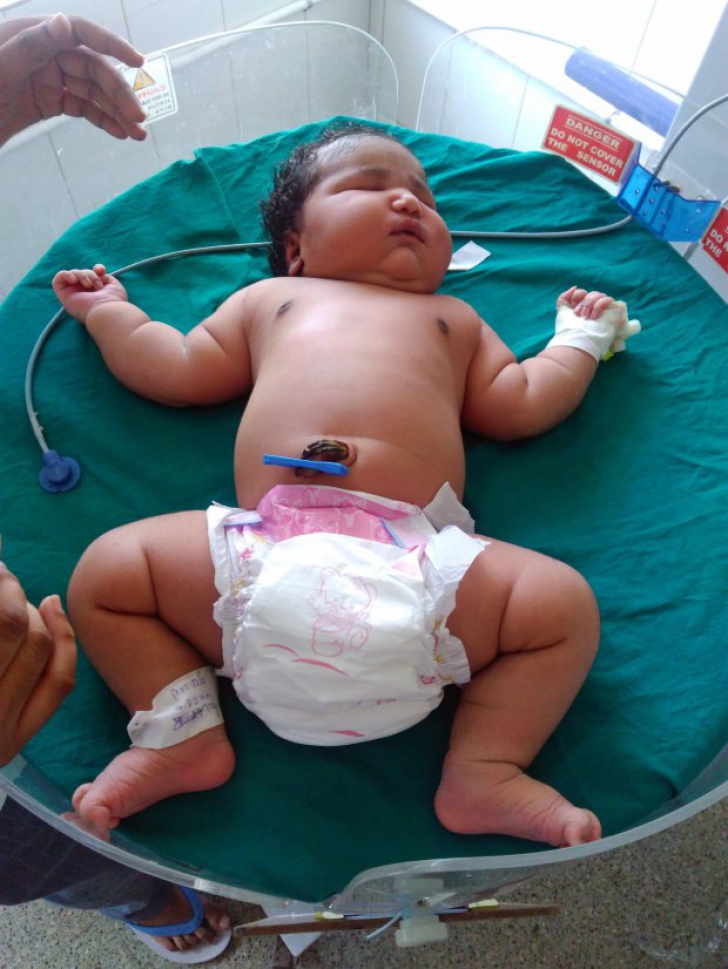 Cum arată cel mai gras bebeluș născut vreodată. Medicii nu au mai văzut așa ceva în cariera lor 