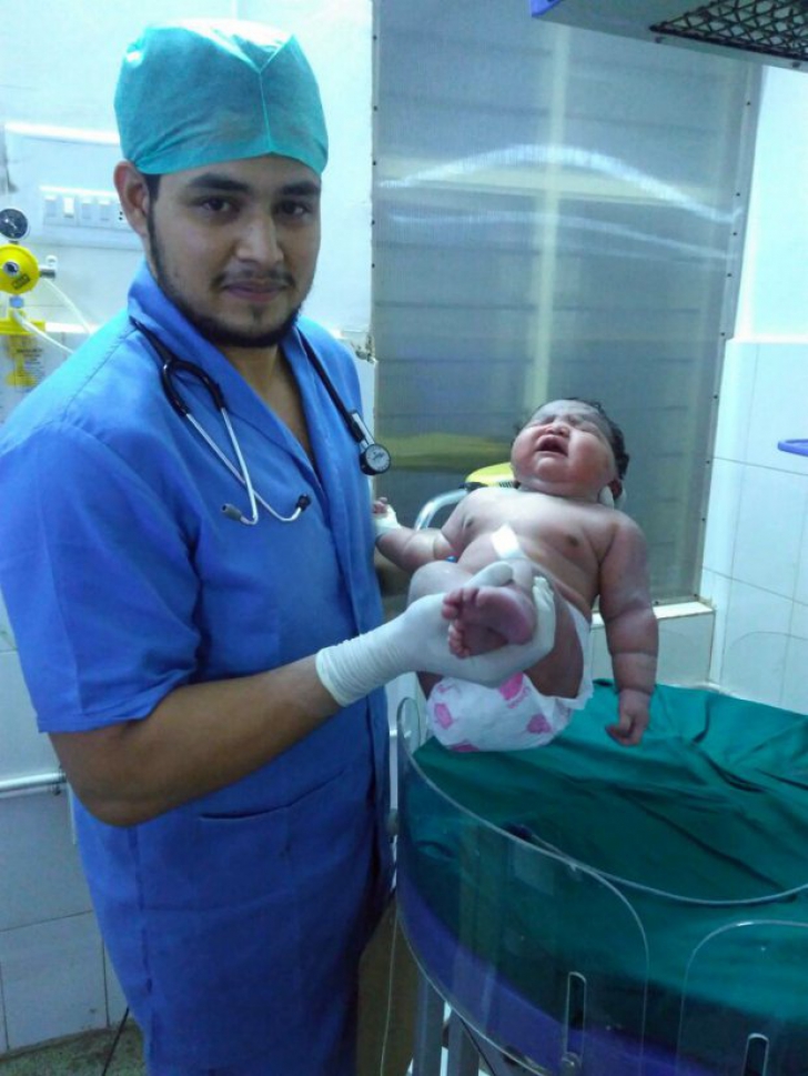 Cum arată cel mai gras bebeluș născut vreodată. Medicii nu au mai văzut așa ceva în cariera lor 