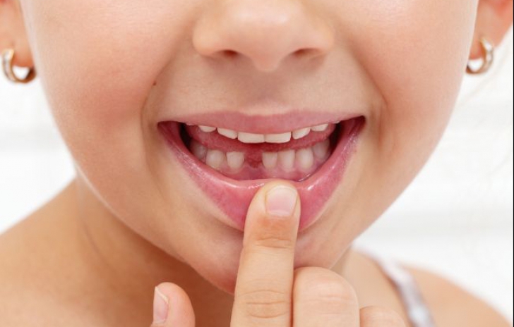 Dinţii de lapte căzuţi de la copii sunt "comori de aur"! Motivul pentru care să nu-i arunci