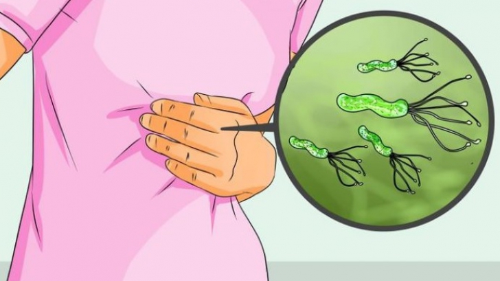 Cum se transmite bacteria care produce cancer de stomac. Jumătate din oameni o au