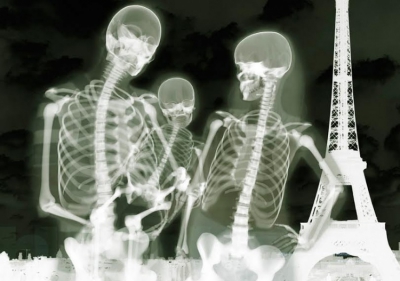 14 radiografii care îți vor schimba modul de a privi corpul uman