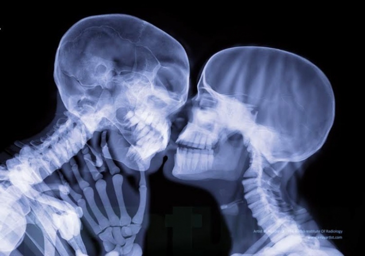 14 radiografii care îți vor schimba modul de a privi corpul uman