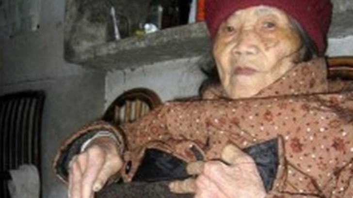 Cazul uimitor al unei femei care a purtat un copil mort în pântece timp de 60 de ani