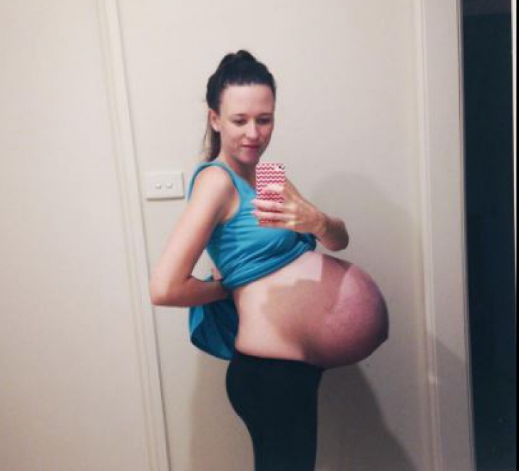  A pus pe Facebook o poză cu burtica de gravidă. Câteva zile mai târziu? ”Oribil. Nu puteam să cred”