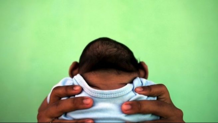 Virusul Zika. S-a născut primul bebeluş din Europa cu microcefalie 
