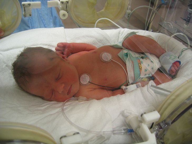 Un doctor a salvat viaţa unui bebeluş născut prematur. Ce s-a întâmplat 30 de ani mai târziu, ireal!