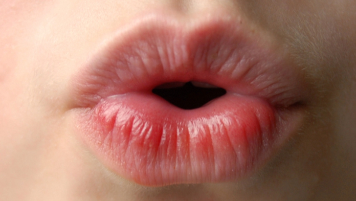 De ce ni se crapă de fapt buzele? Medicii trag un semnal de alarmă 