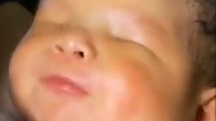 Bebelușul lor nu a deschis ochii nici la o săptămână după naștere. Când l-au privit mai atent, șoc