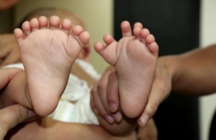 Un bebeluş s-a născut cu 31 de degete! Terifiaţi, medicii au luat o DECIZIE înfiorătoare