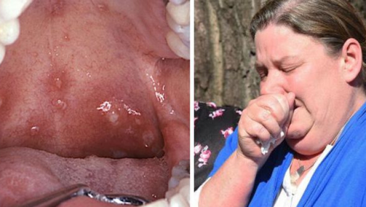 I-au aparut afte în gât, însă medicii au ignorat-o. De ce A MURIT, de fapt, o fetiţă de 10 ani