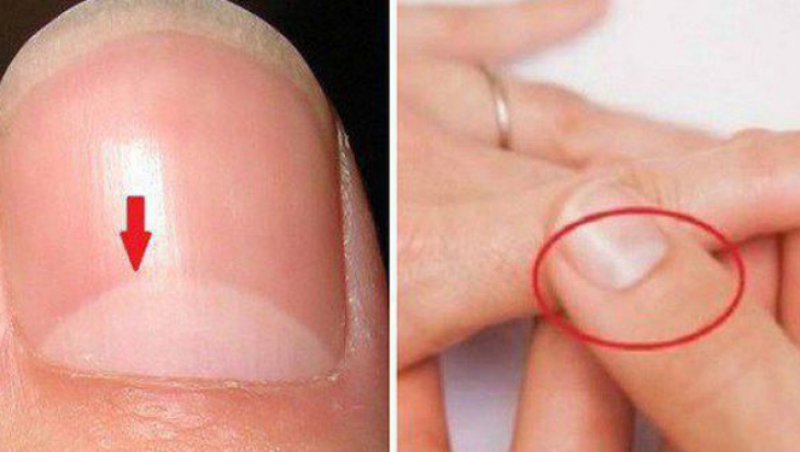 Ştii ce înseamnă semiluna de pe unghiile tale? Răspunsul este mai important decât crezi!