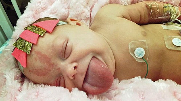 Când a născut, medicii i-au spus că o va şoca felul în care arată bebeluşul. Acum poate zâmbi!