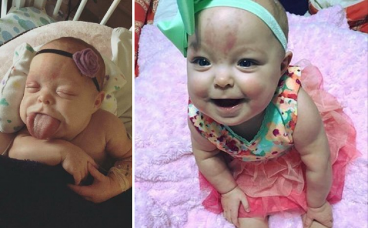 Când a născut, medicii i-au spus că o va şoca felul în care arată bebeluşul. Acum poate zâmbi!