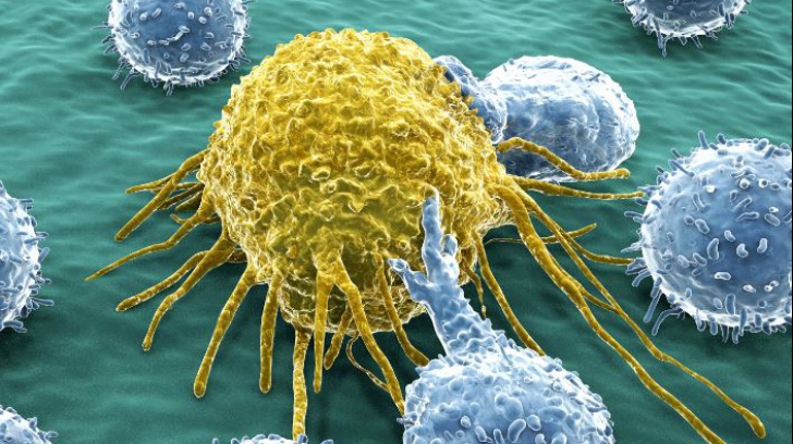 Au fost ținute secrete până acum. 5 riscuri de cancer la care ne expunem zilnic